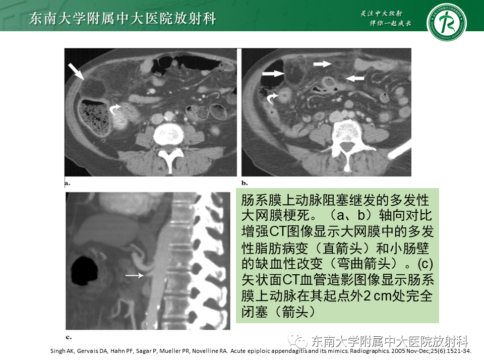 影像PPT - 【PPT】肠脂垂炎-27
