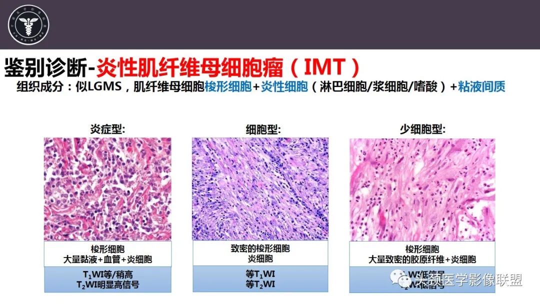 影像PPT - 【病例】咬肌间隙肌纤维母细胞肉瘤1例MR诊断与鉴别-22