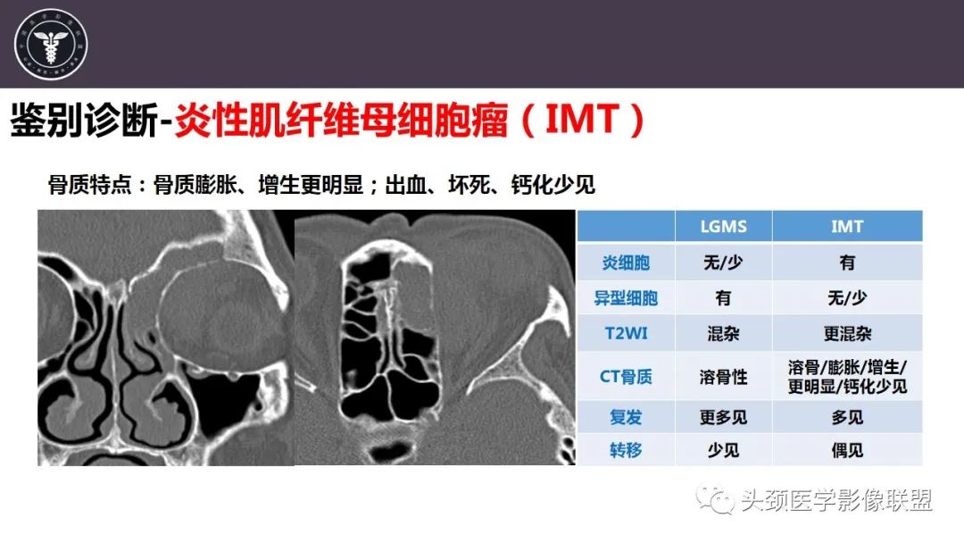影像PPT - 【病例】咬肌间隙肌纤维母细胞肉瘤1例MR诊断与鉴别-25