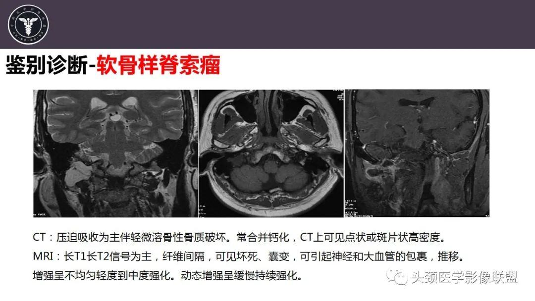 影像PPT - 【病例】咬肌间隙肌纤维母细胞肉瘤1例MR诊断与鉴别-27