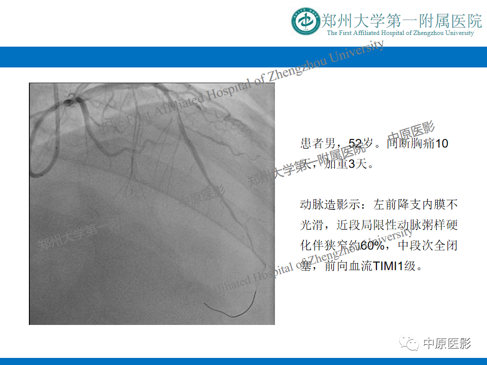 影像PPT - 【病例】致心律失常性右室心肌病1例MR影像-25