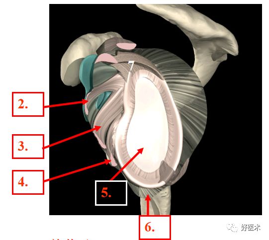影像PPT - 肩关节损伤的影像学诊断-5 影像PPT - 肩关节损伤的影像学诊断-5