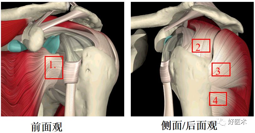 影像PPT - 肩关节损伤的影像学诊断-8 影像PPT - 肩关节损伤的影像学诊断-8