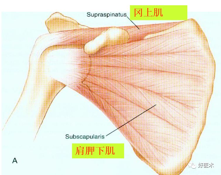 影像PPT - 肩关节损伤的影像学诊断-9 影像PPT - 肩关节损伤的影像学诊断-9