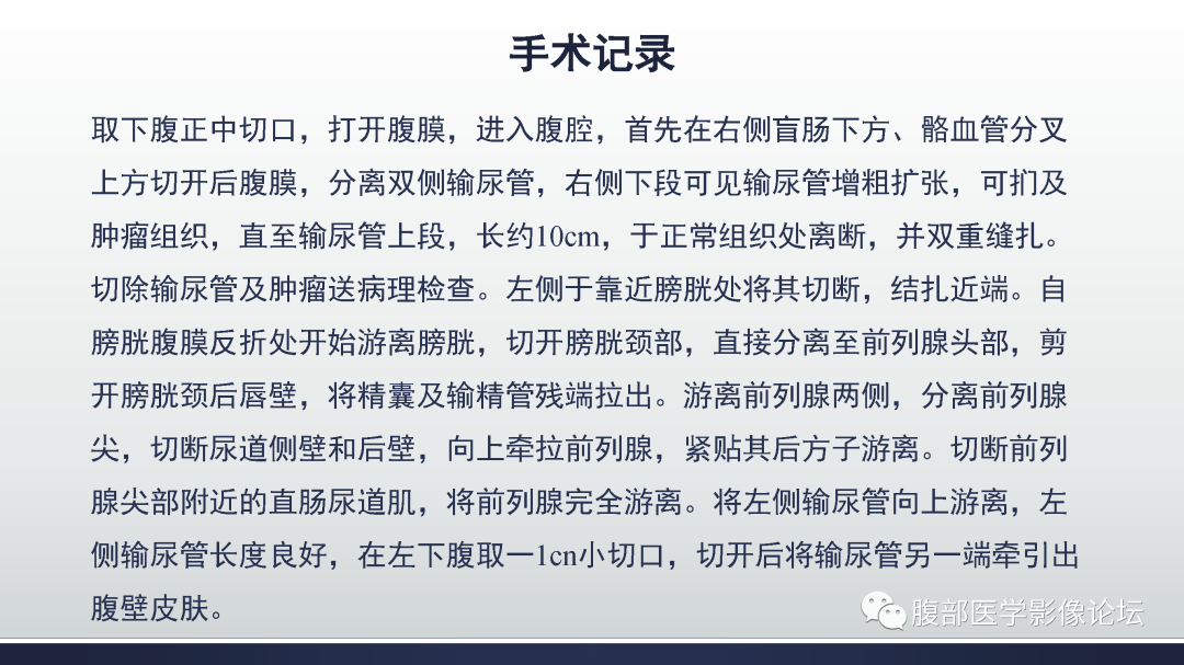 影像PPT - 【病例】膀胱癌—高级别浸润性尿路上皮癌1例CT及MR影像诊断及鉴别-7