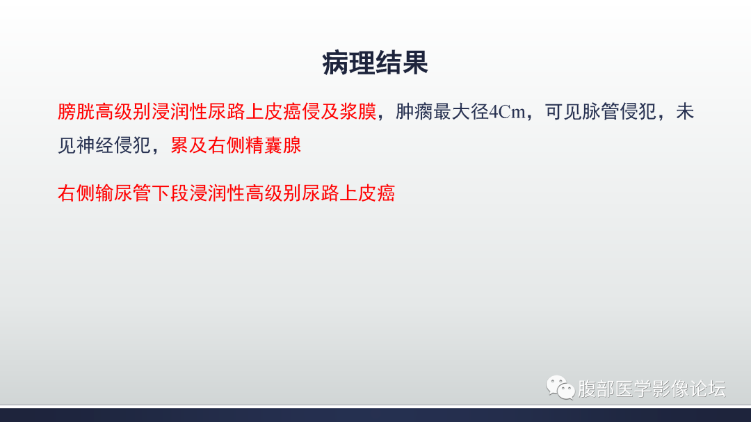 影像PPT - 【病例】膀胱癌—高级别浸润性尿路上皮癌1例CT及MR影像诊断及鉴别-8