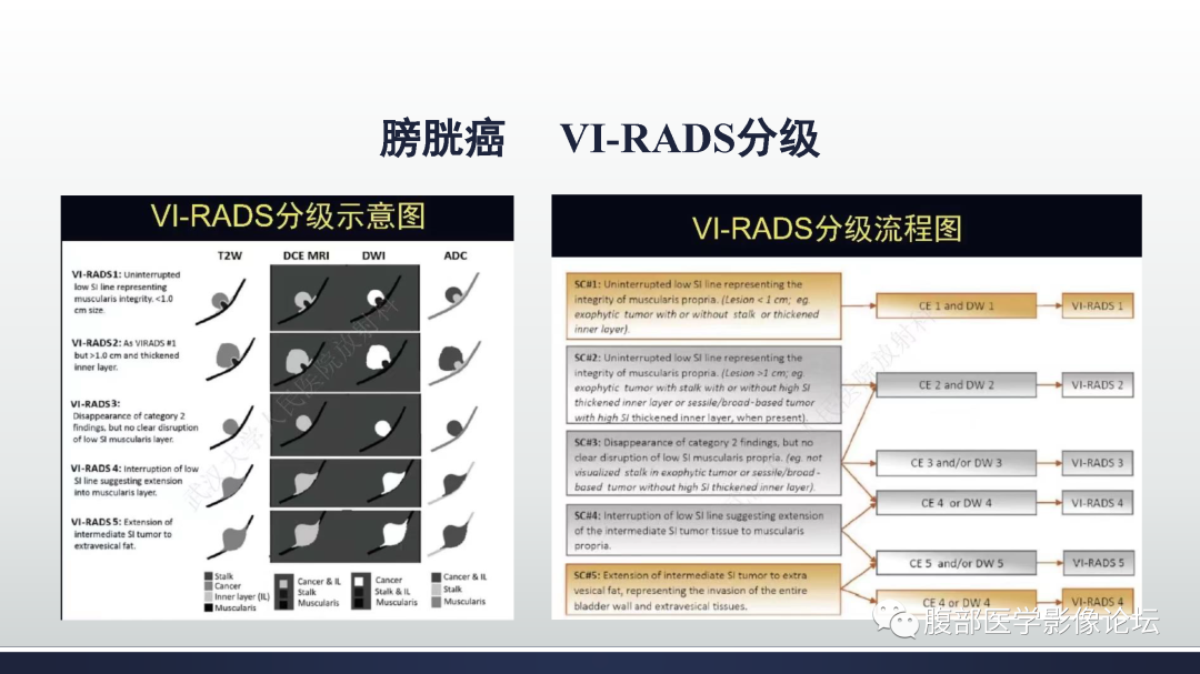 影像PPT - 【病例】膀胱癌—高级别浸润性尿路上皮癌1例CT及MR影像诊断及鉴别-36