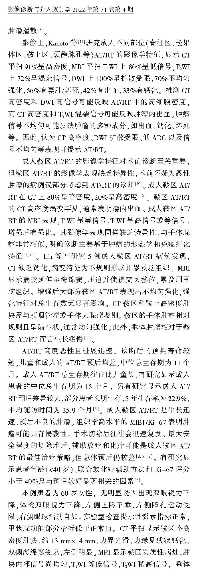 影像PPT - 【病例】鞍区恶性肿瘤—非典型畸胎样/横纹肌样肿瘤1例CT及MR影像诊断思维-8