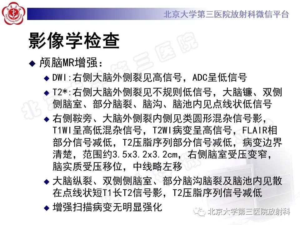 影像PPT - 【PPT】颅内皮样囊肿-7