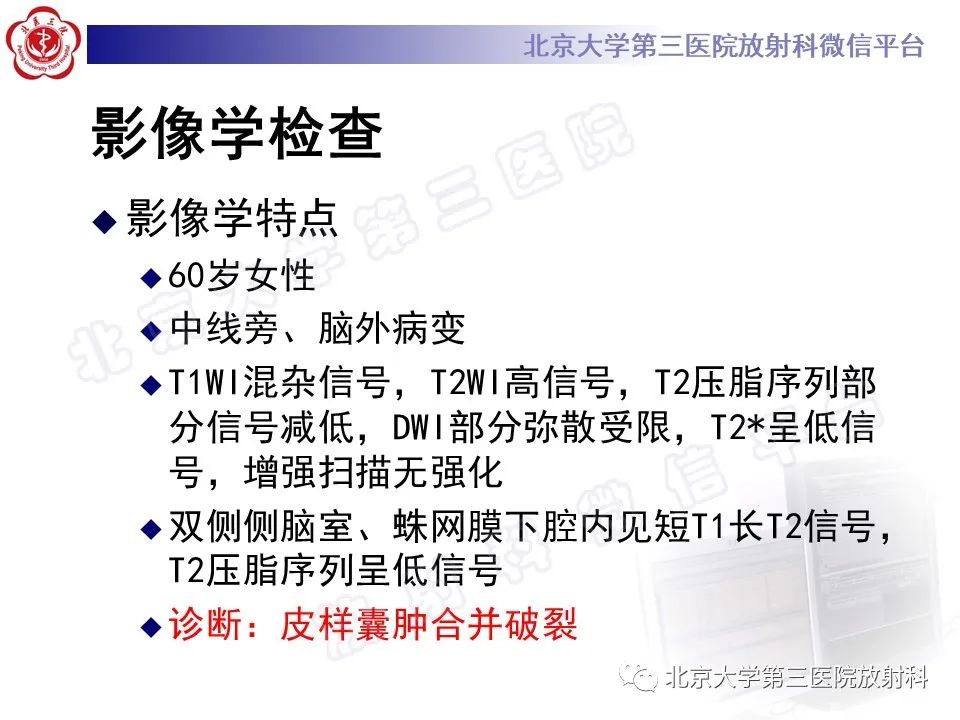 影像PPT - 【PPT】颅内皮样囊肿-8