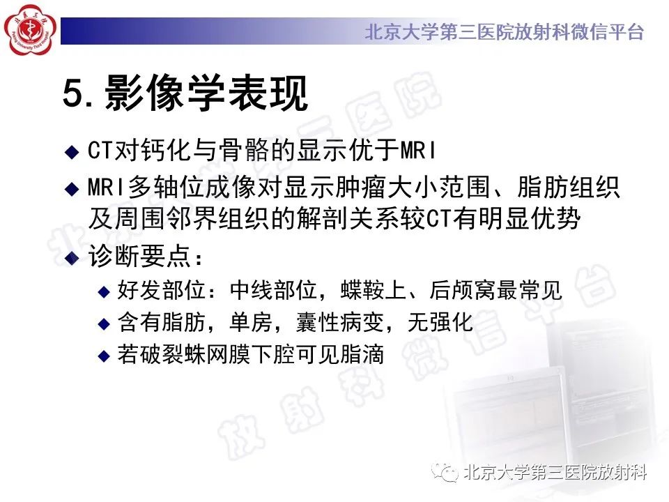 影像PPT - 【PPT】颅内皮样囊肿-16
