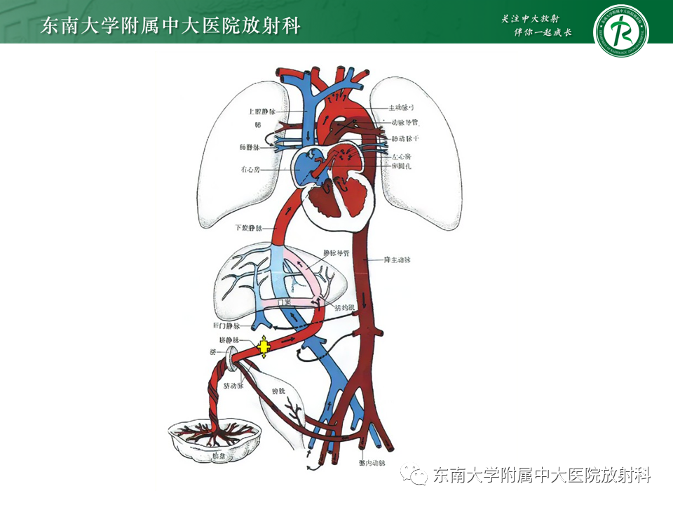 影像PPT - 【PPT】体内常见置管位置影像评估-25