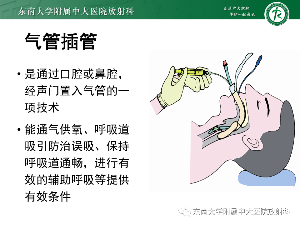 影像PPT - 【PPT】体内常见置管位置影像评估-33