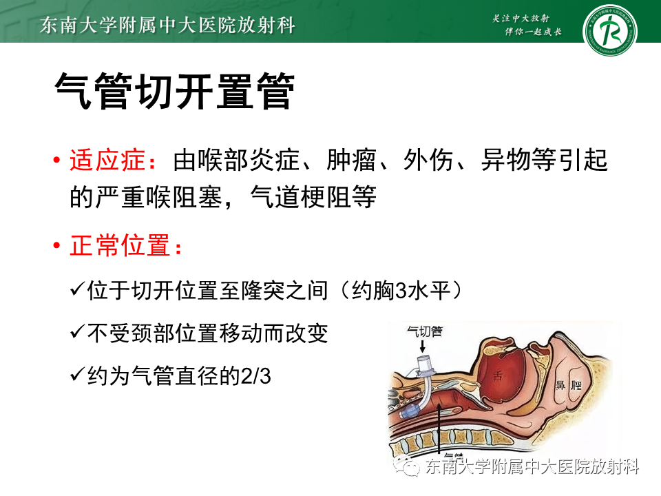 影像PPT - 【PPT】体内常见置管位置影像评估-35