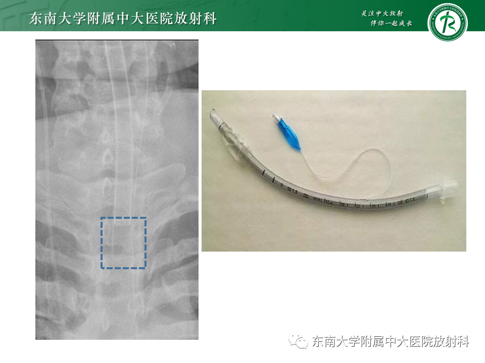 影像PPT - 【PPT】体内常见置管位置影像评估-38