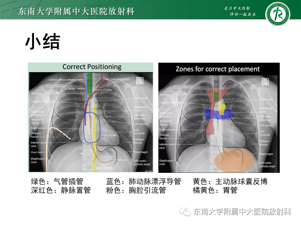 影像PPT - 【PPT】体内常见置管位置影像评估-61