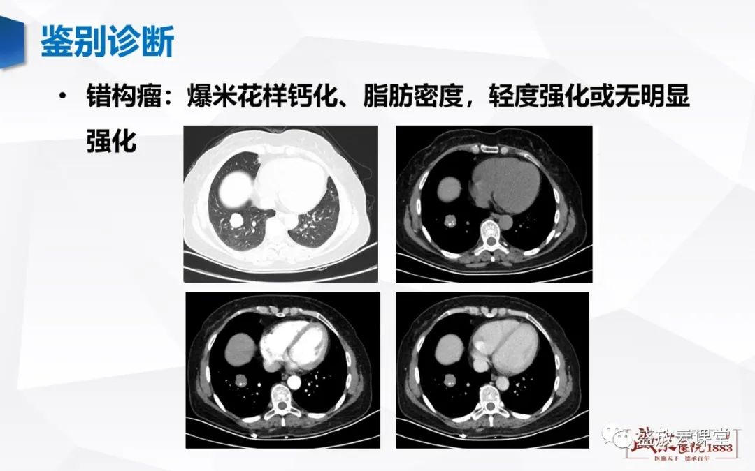 影像PPT - 【病例】硬化性肺细胞瘤1例CT影像-9