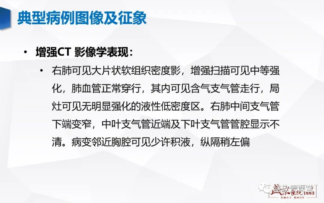 影像PPT - 【病例】肺淋巴瘤(MALT)一例CT影像-3