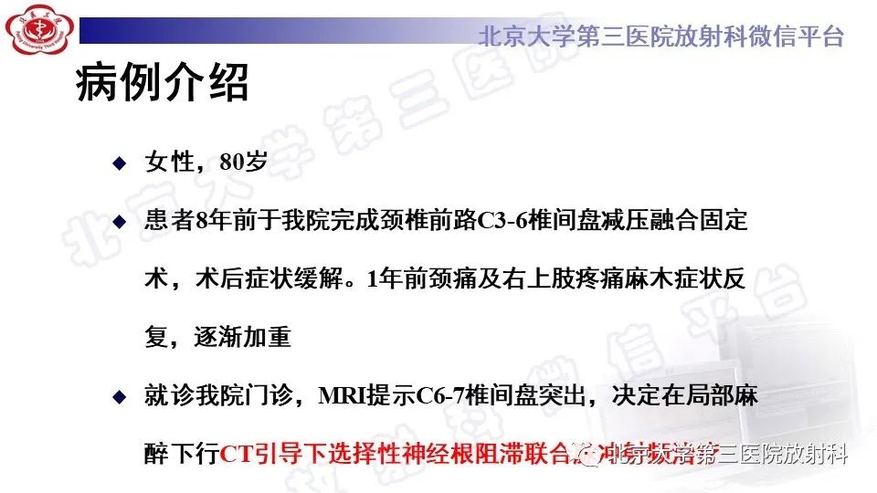 影像PPT - 【PPT】CT引导下介入技术在脊柱退行性疾病诊疗中的应用-3