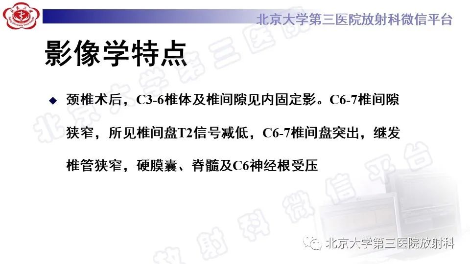 影像PPT - 【PPT】CT引导下介入技术在脊柱退行性疾病诊疗中的应用-5