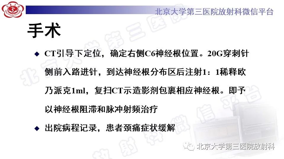 影像PPT - 【PPT】CT引导下介入技术在脊柱退行性疾病诊疗中的应用-7
