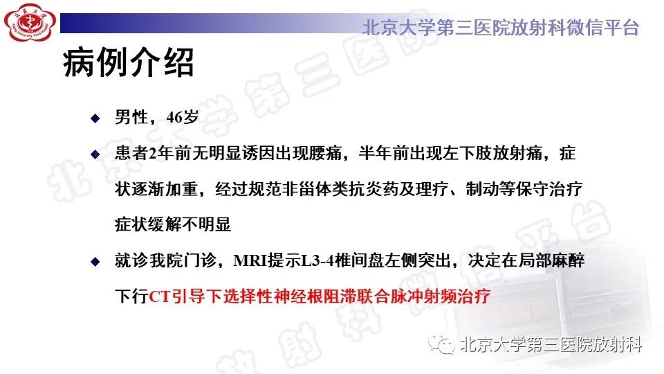 影像PPT - 【PPT】CT引导下介入技术在脊柱退行性疾病诊疗中的应用-9