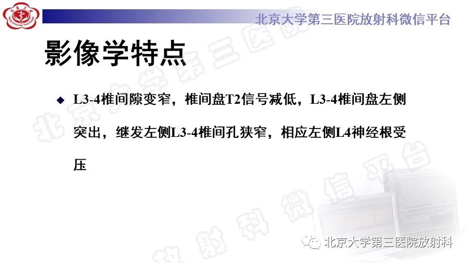 影像PPT - 【PPT】CT引导下介入技术在脊柱退行性疾病诊疗中的应用-11