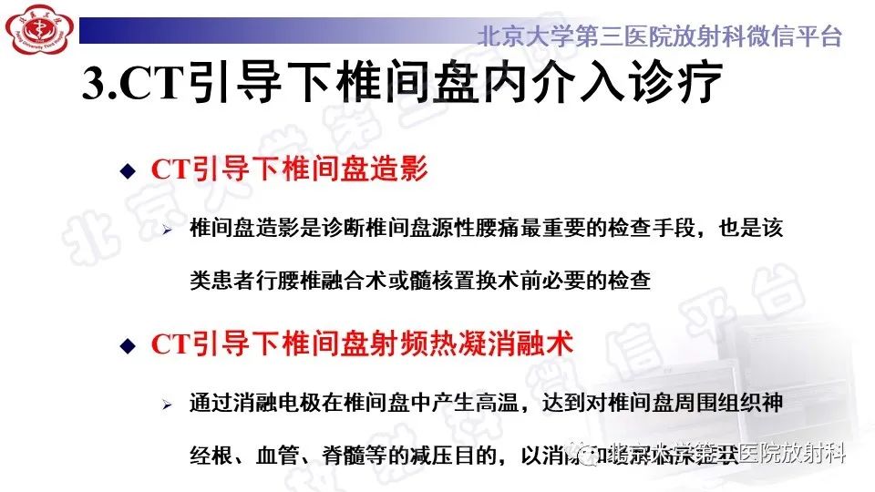 影像PPT - 【PPT】CT引导下介入技术在脊柱退行性疾病诊疗中的应用-22
