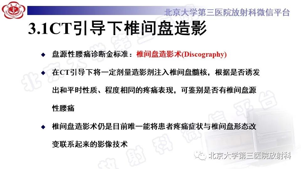 影像PPT - 【PPT】CT引导下介入技术在脊柱退行性疾病诊疗中的应用-24