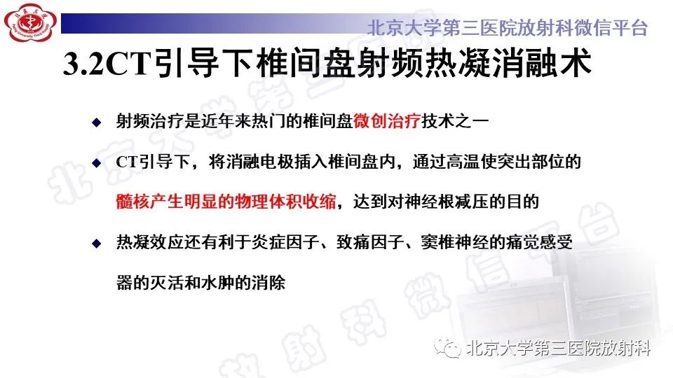 影像PPT - 【PPT】CT引导下介入技术在脊柱退行性疾病诊疗中的应用-25