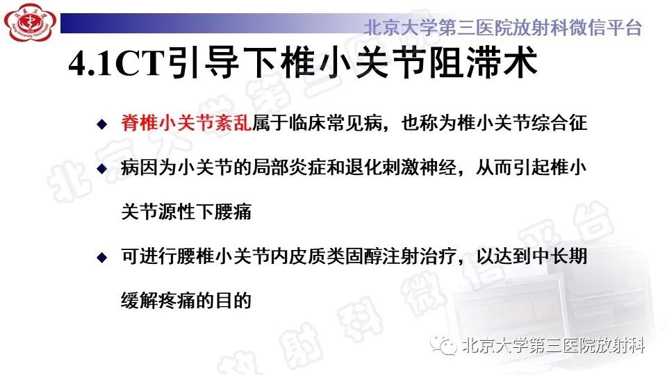 影像PPT - 【PPT】CT引导下介入技术在脊柱退行性疾病诊疗中的应用-27