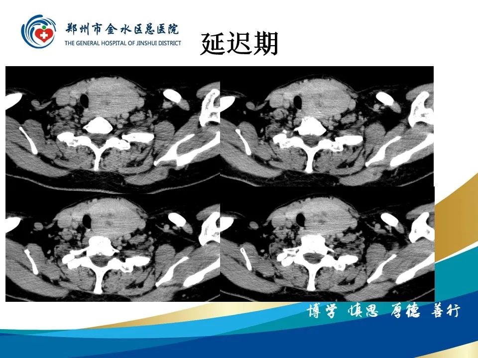 影像PPT - 【PPT】甲状腺常见相关疾病的影像诊断-12