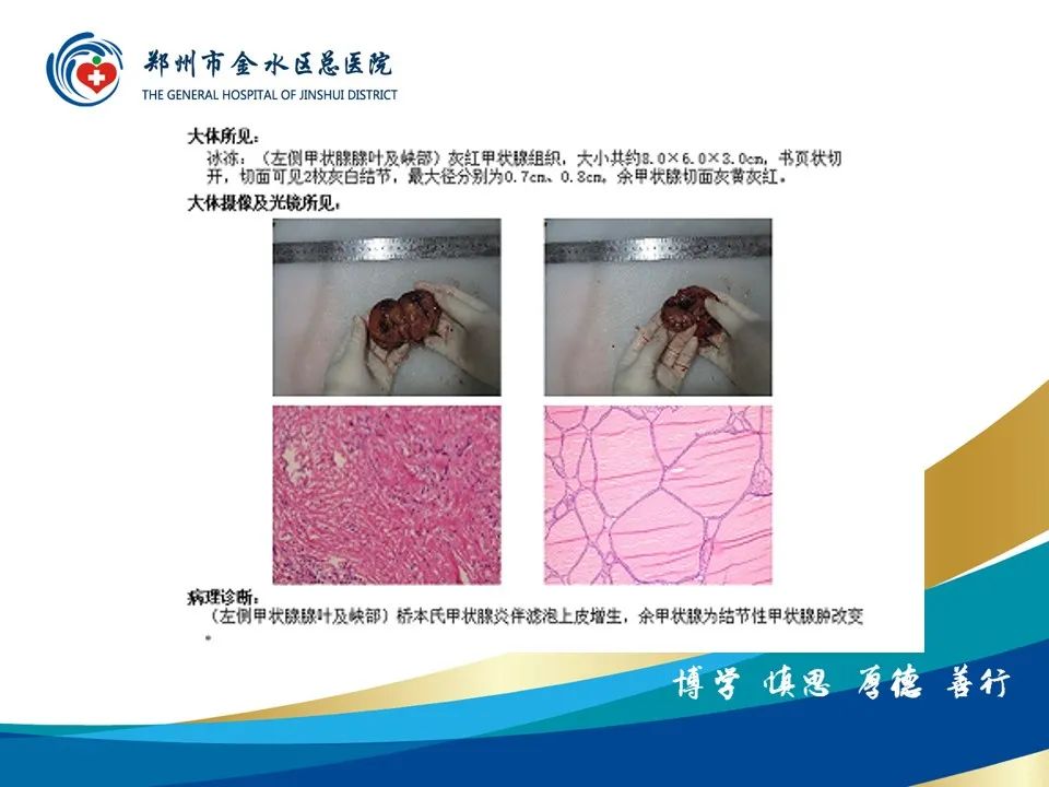 影像PPT - 【PPT】甲状腺常见相关疾病的影像诊断-14