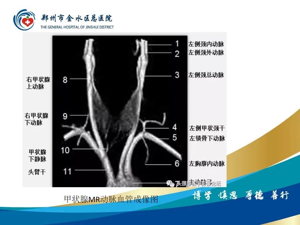 影像PPT - 【PPT】甲状腺常见相关疾病的影像诊断-19