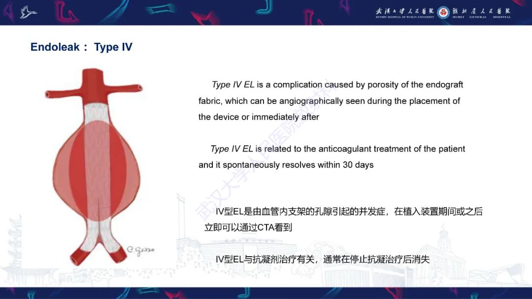 影像PPT - 【PPT】腹主动脉瘤EVAR术后并发症CT评估-19