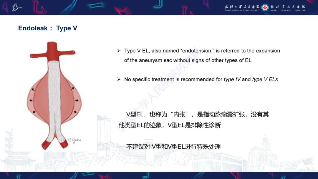 影像PPT - 【PPT】腹主动脉瘤EVAR术后并发症CT评估-21