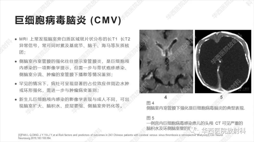 影像PPT - 【病例】出血坏死性病毒脑膜脑炎1例CT及MR影像学表现和鉴别诊断-19