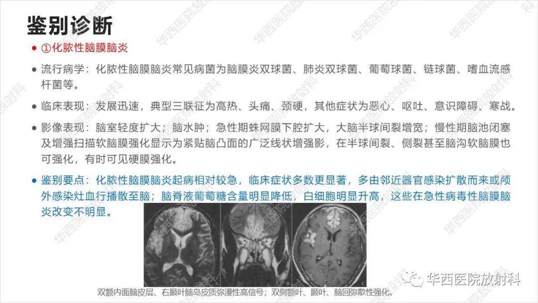 影像PPT - 【病例】出血坏死性病毒脑膜脑炎1例CT及MR影像学表现和鉴别诊断-22