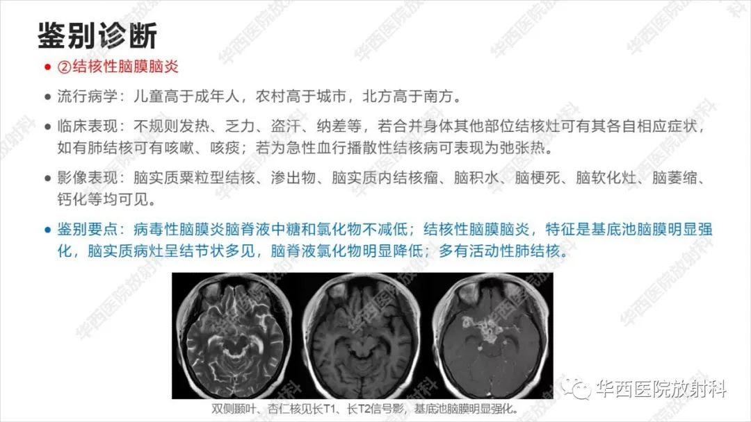 影像PPT - 【病例】出血坏死性病毒脑膜脑炎1例CT及MR影像学表现和鉴别诊断-23