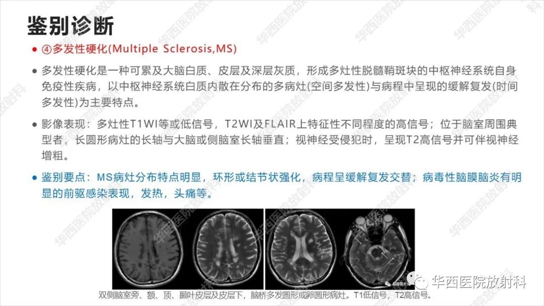 影像PPT - 【病例】出血坏死性病毒脑膜脑炎1例CT及MR影像学表现和鉴别诊断-25