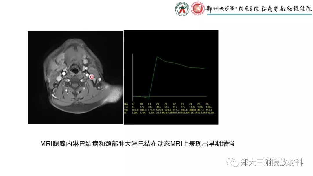 影像PPT - 【PPT】木村病(kimura disease)临床特征及MR表现-11