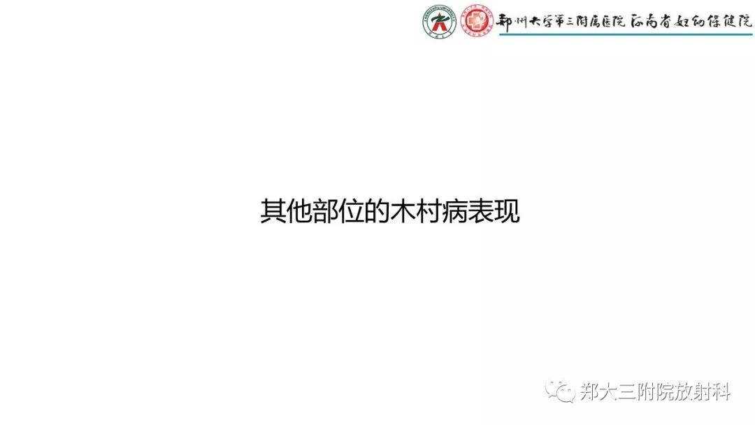 影像PPT - 【PPT】木村病(kimura disease)临床特征及MR表现-15
