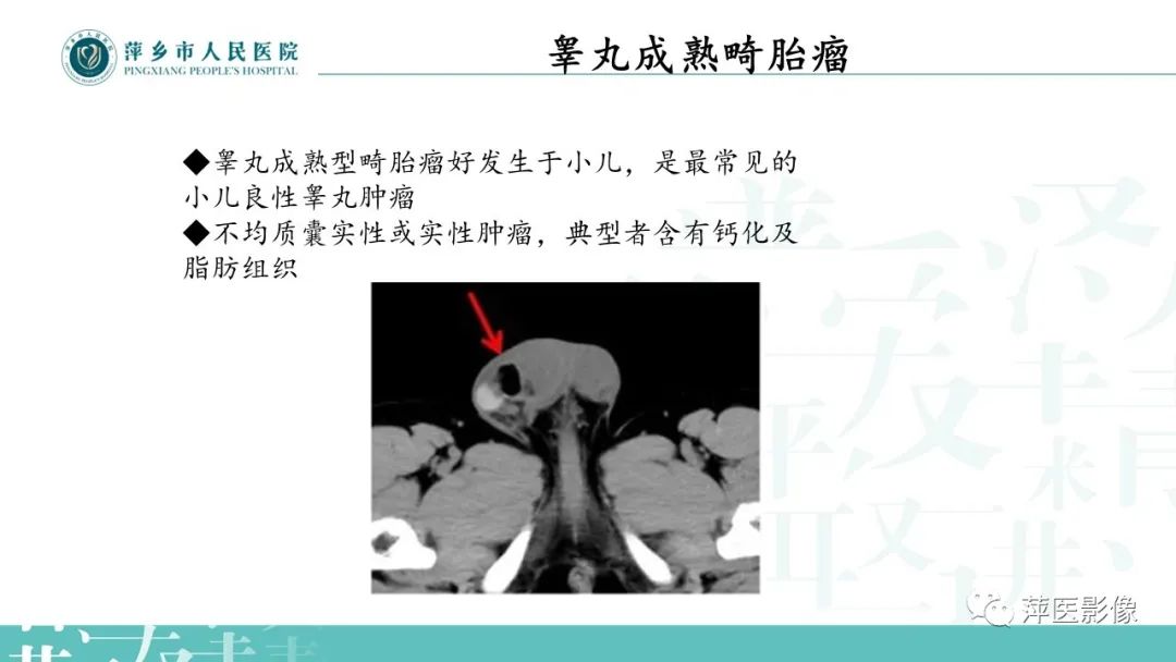 影像PPT - 【PPT】睾丸精原细胞瘤-19