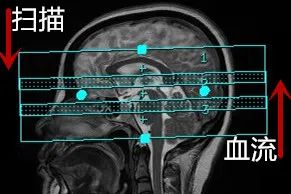 影像PPT - 颅内3D TOF-MRA成像中的几个技术要点-3 影像PPT - 颅内3D TOF-MRA成像中的几个技术要点-3