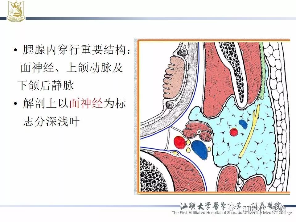 影像PPT - 【PPT】腮腺病变CT诊断-3