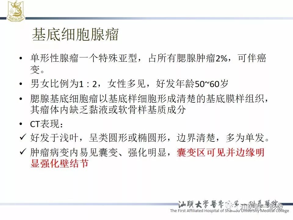 影像PPT - 【PPT】腮腺病变CT诊断-57