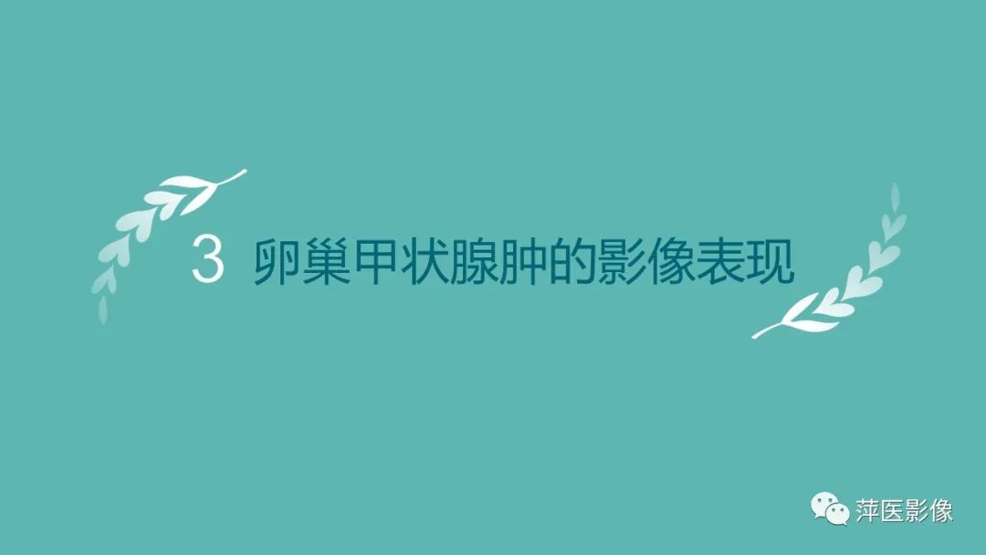 影像PPT - 【PPT】卵巢甲状腺肿-8