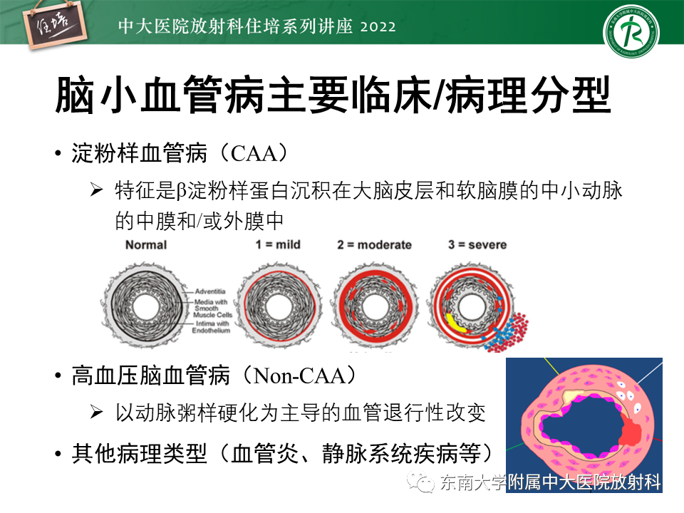 影像PPT - 【PPT】脑小血管病概念、影像维度及其深度学习进展-5
