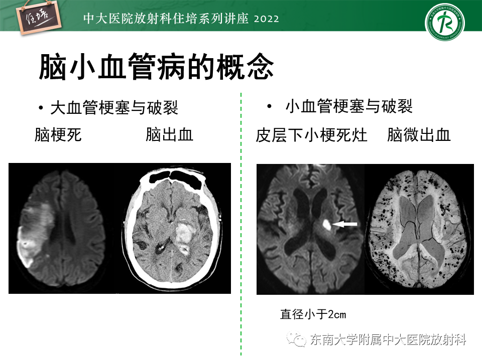 影像PPT - 【PPT】脑小血管病概念、影像维度及其深度学习进展-4