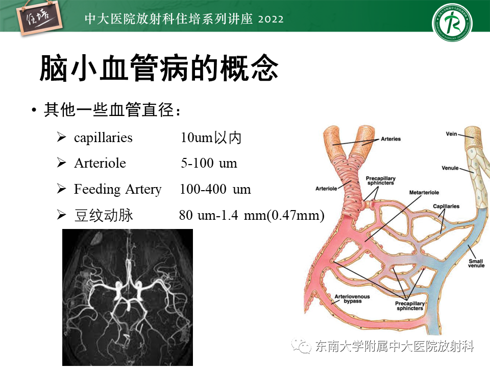 影像PPT - 【PPT】脑小血管病概念、影像维度及其深度学习进展-3